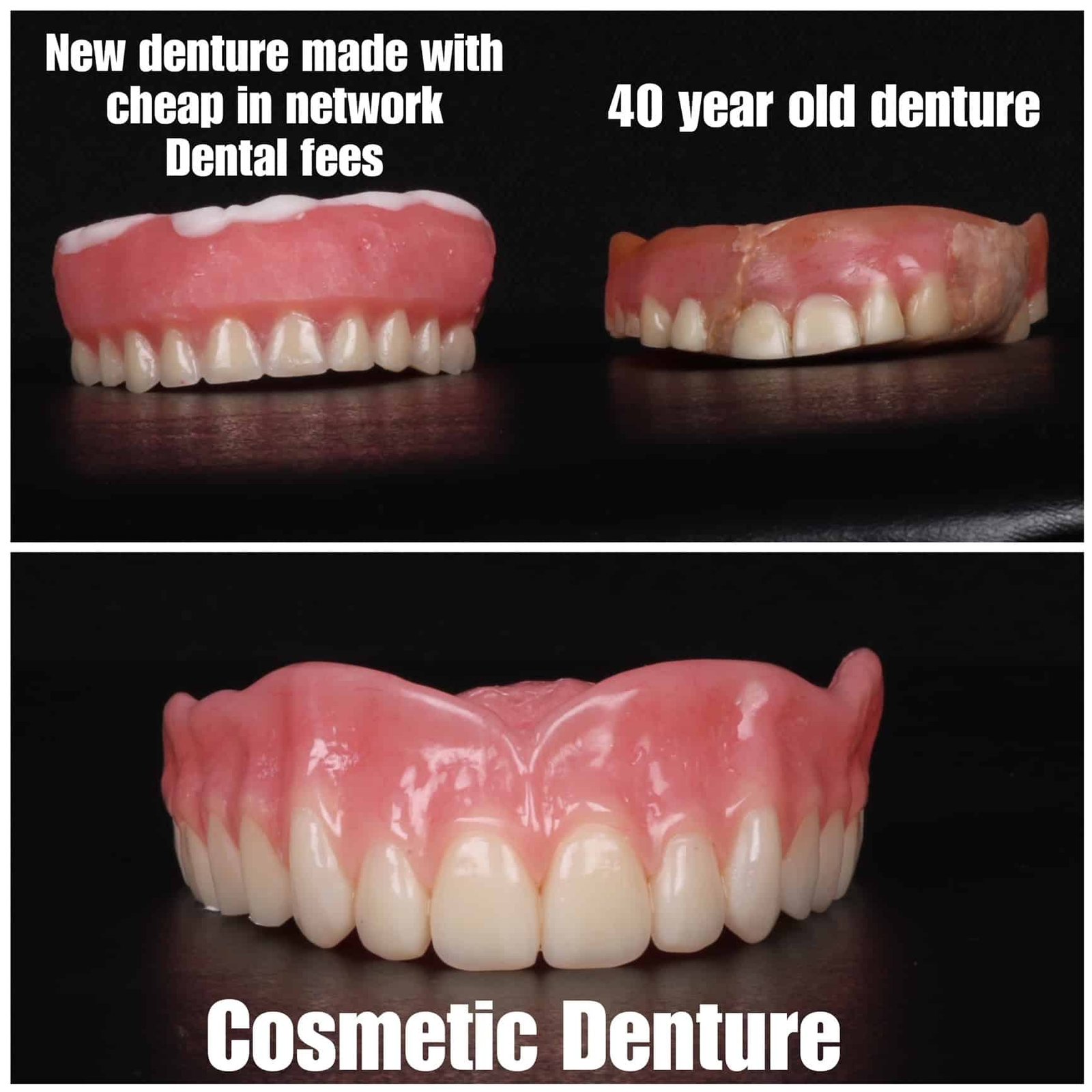 Cosmetic Dentures 1 Austin Cosmetic Dentist